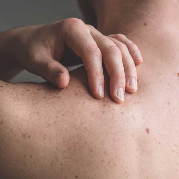 Skincare Product/Patch Study